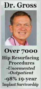 Dr. Gross of SC Hip Resurfacing Surgeon with over 6000 hip resurfacings