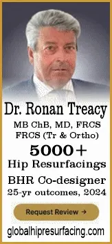 Dr. Treacy Hip Resurfacing Surgeon